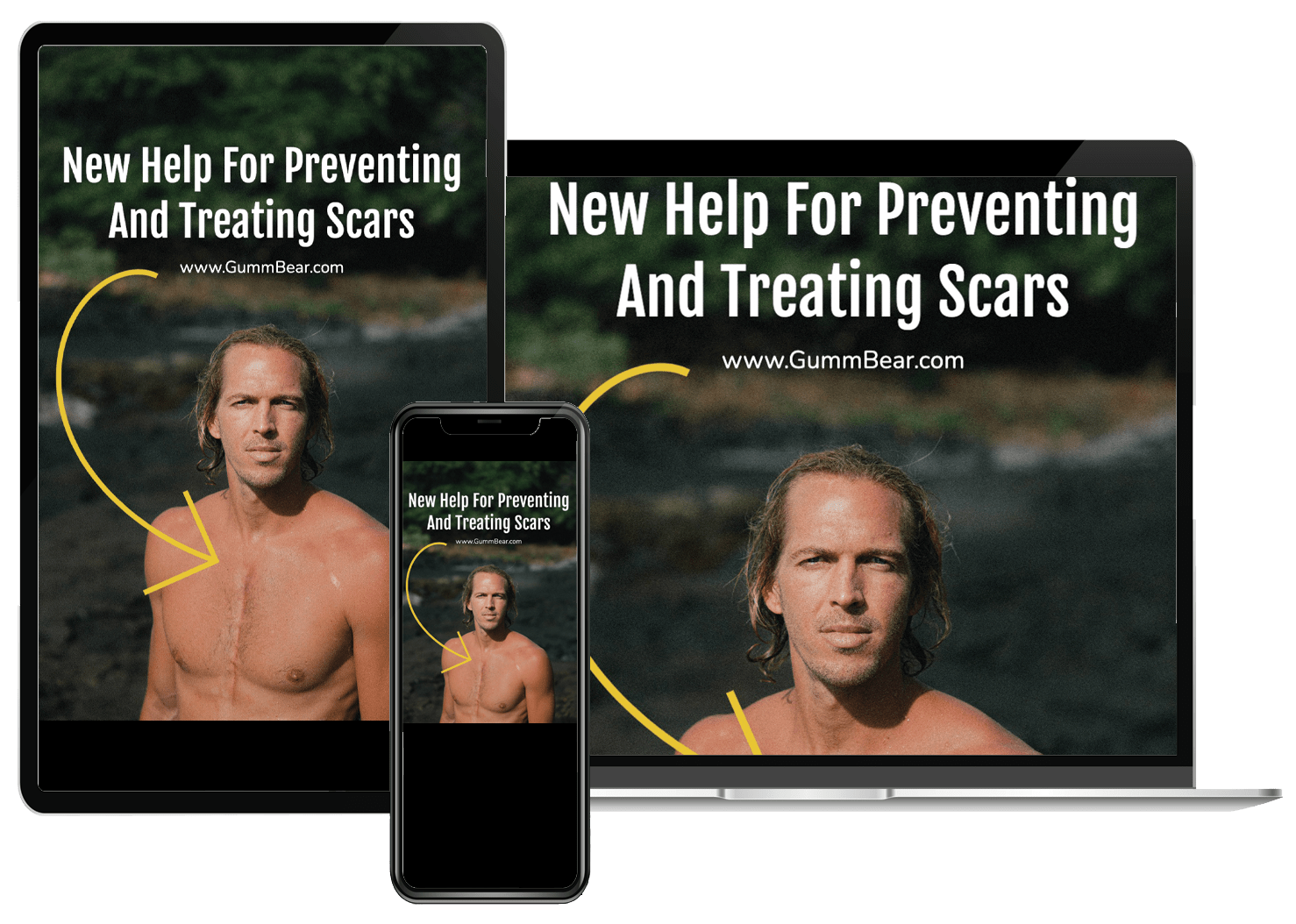 GummBear Short e-Article - New Help For Preventing And Treating Scars